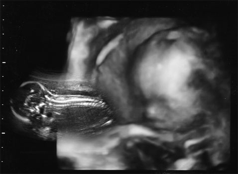 Baby Ultrasound